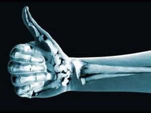 Ease Inflammation Issues With Omega-3